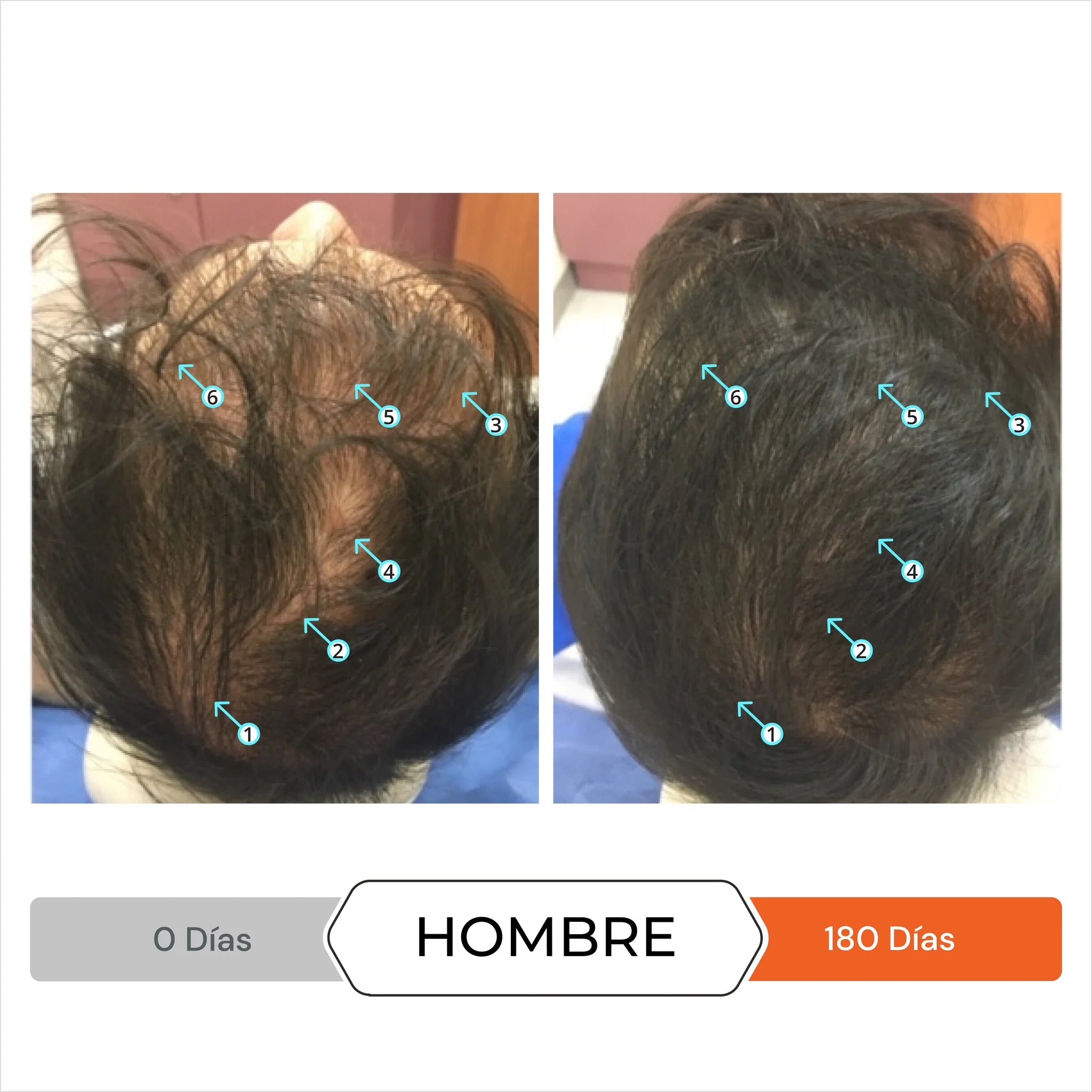 DS Laboratories - Revita Complemento Nutricional Anticaída Pelo 90 comp (3meses)