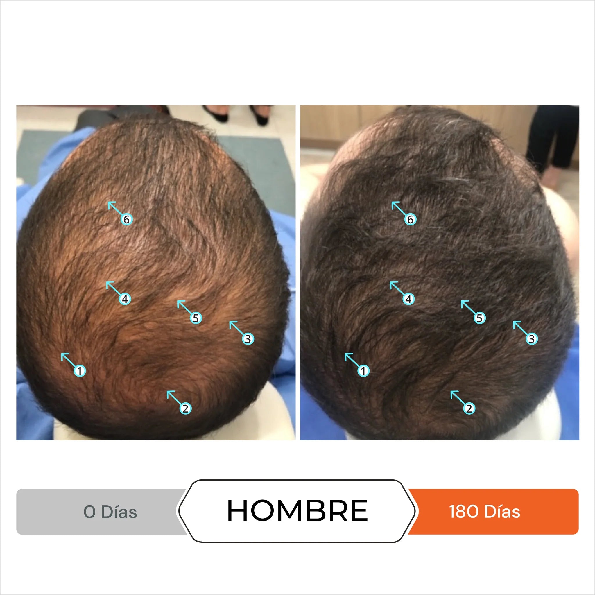 DS Laboratories - Revita Complemento Nutricional Anticaída Pelo 90 comp (3meses)
