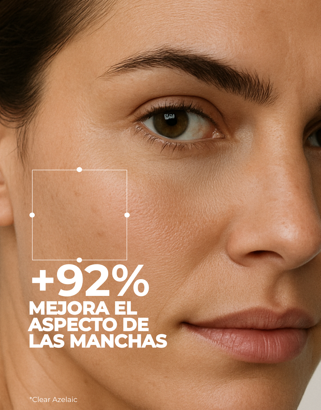 Contenido del cofre: Clear Azelaic, Sérum Glicolmix y Clear Skin R